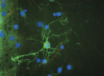 A neural cell derived from an adult stem cell
Image courtesy of the Centre for Stem Cell Research