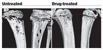 In vivo micro-CT imaging of the tibia shows areas of bone destruction and the result after drug treatment