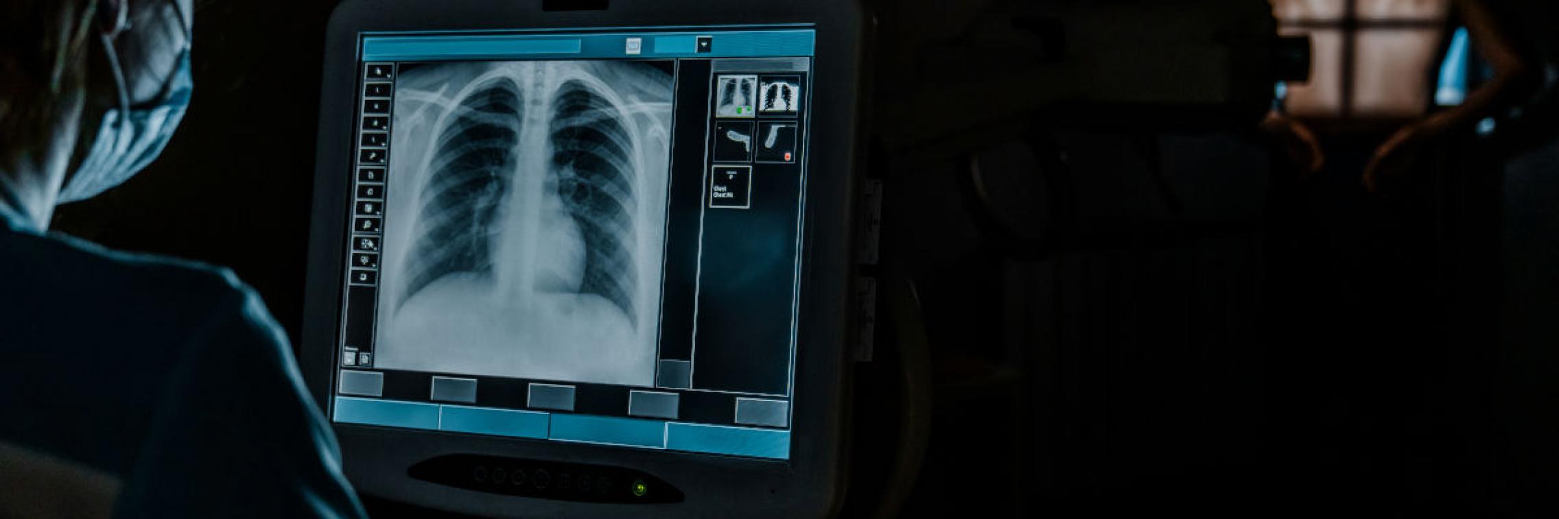 A posed stock photograph of a radiographer looking at a chest x-ray on a computer screen