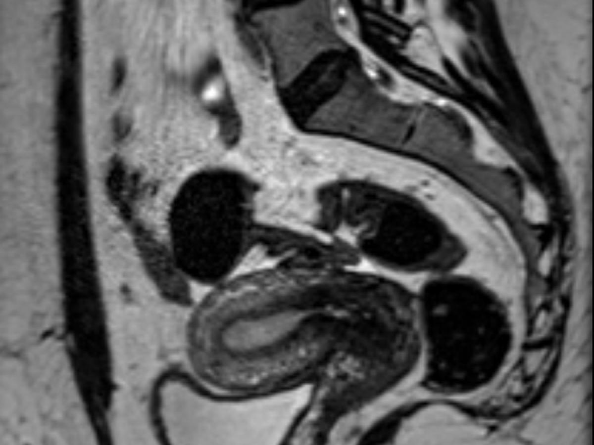 A sample MRI image