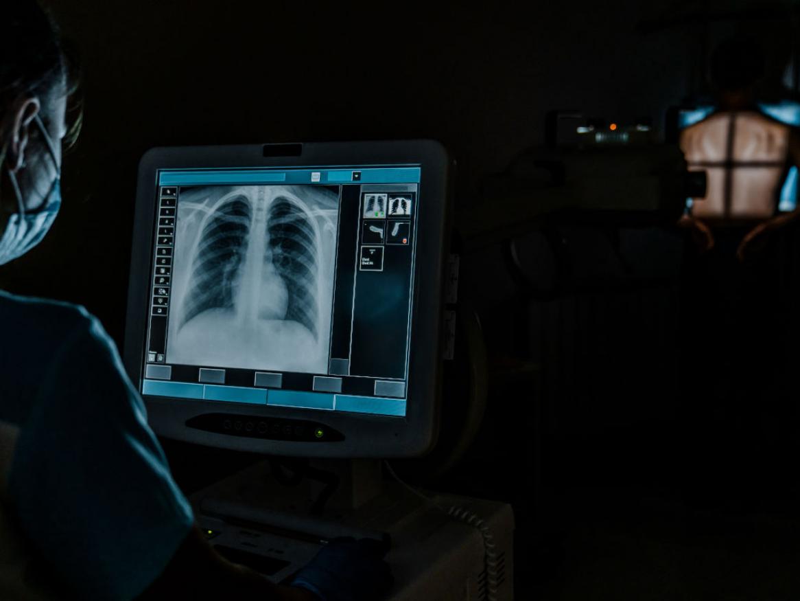 A posed stock photograph of a radiographer looking at a chest x-ray on a computer screen