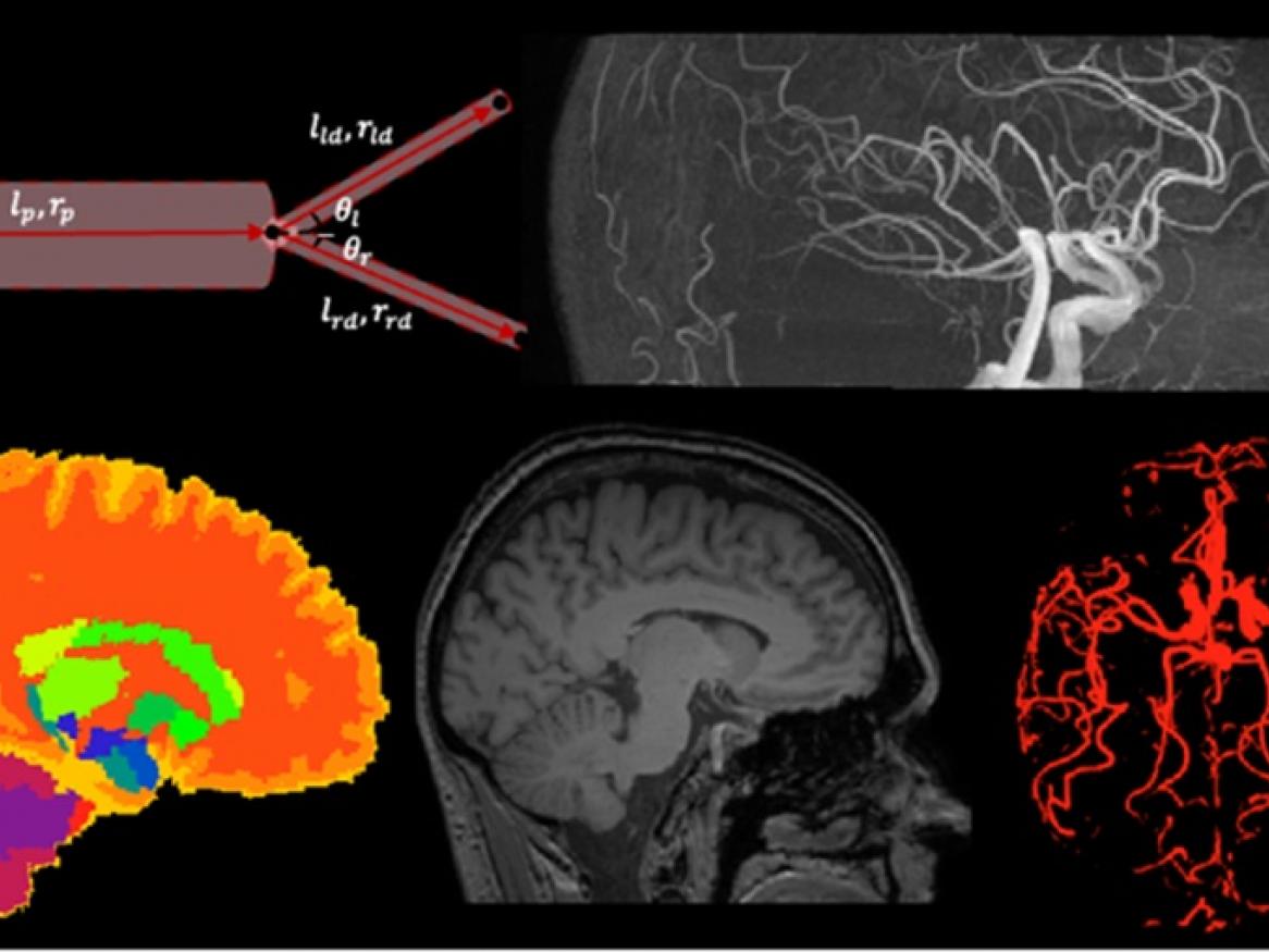 Brain image