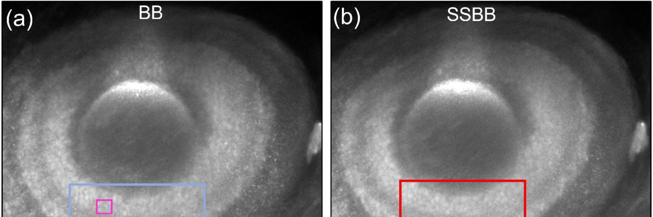 Imaging cell nuclei of the zebrafish eye using Bessel beam and Sidelobe Suppressed Bessel beam. Scale bar: 50 micron