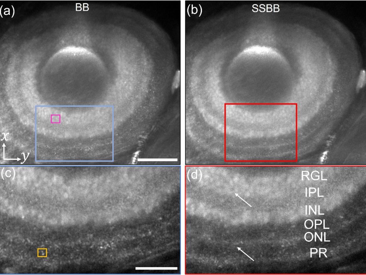Imaging cell nuclei of the zebrafish eye using Bessel beam and Sidelobe Suppressed Bessel beam. Scale bar: 50 micron