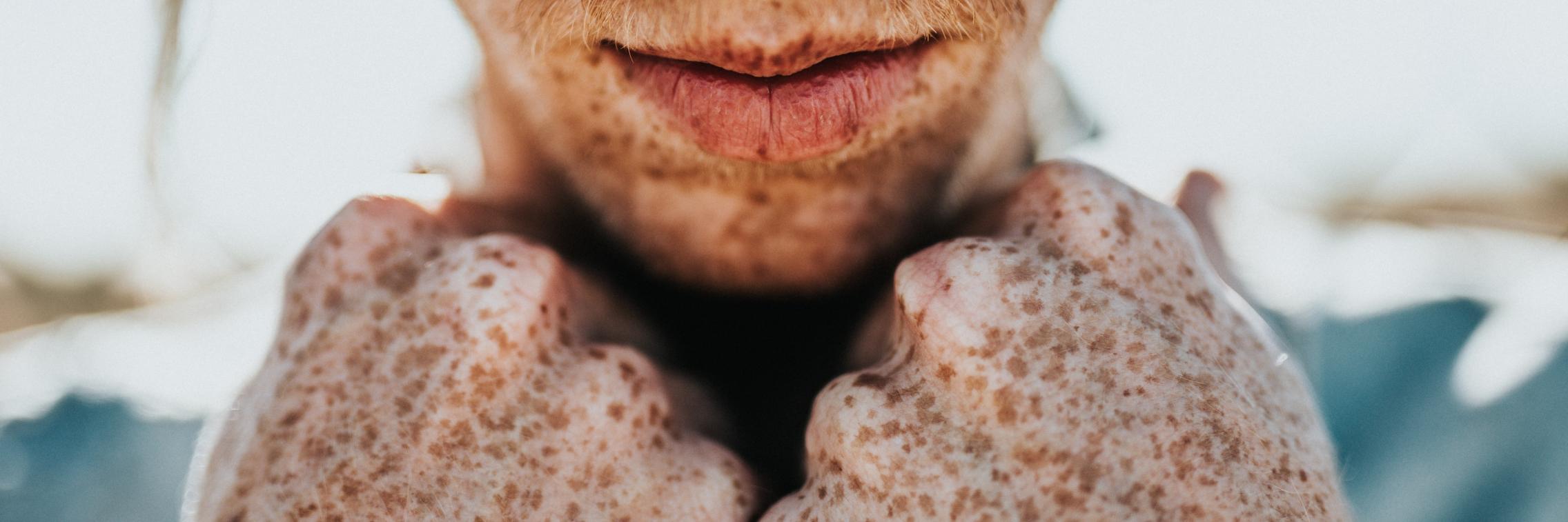 skin health