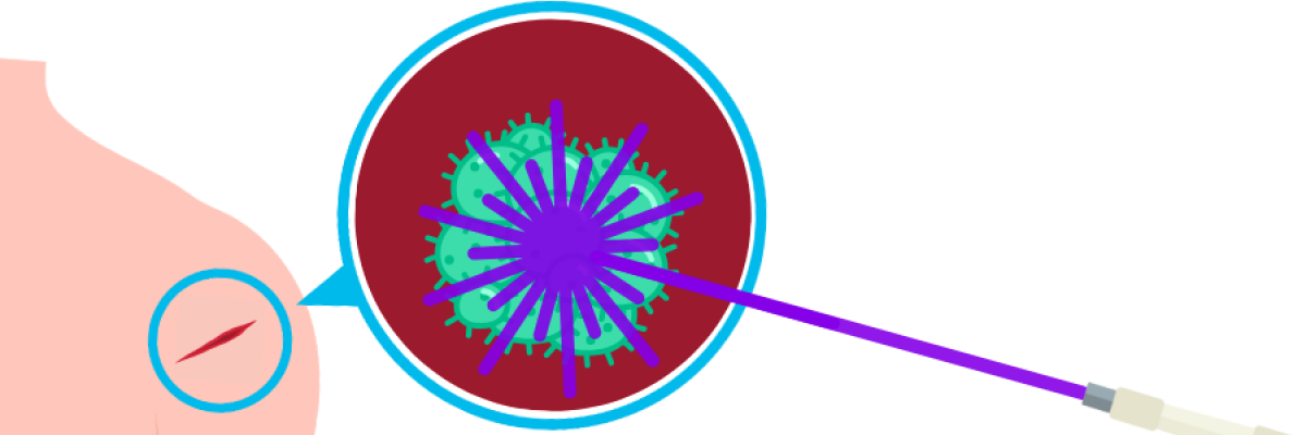 Far-UVC laser medical device
