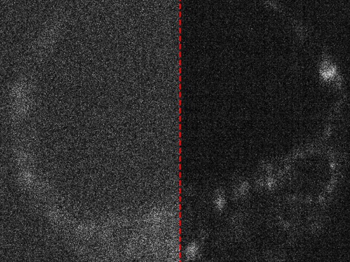 CCD Image of Live Mouse Embryo