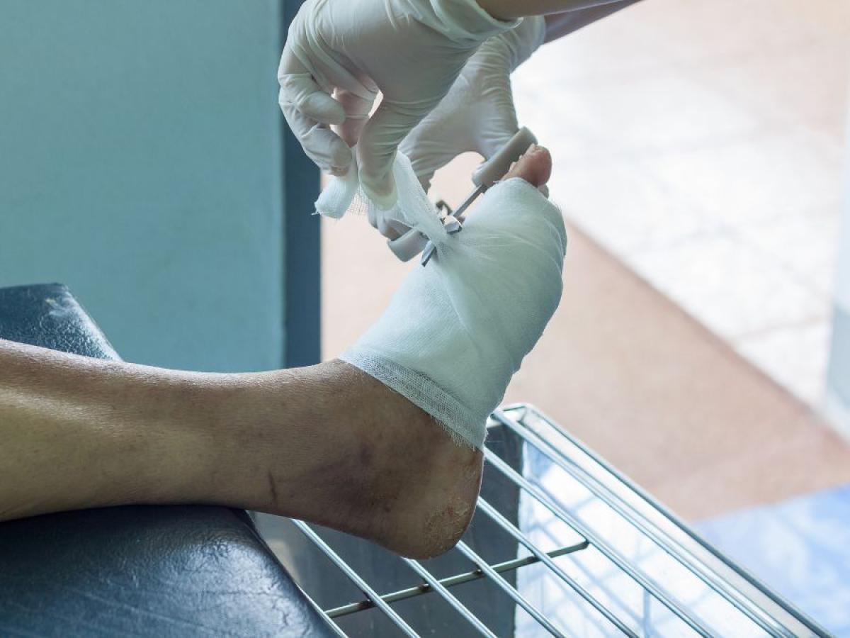 Diabetic Foot Ulcer Care