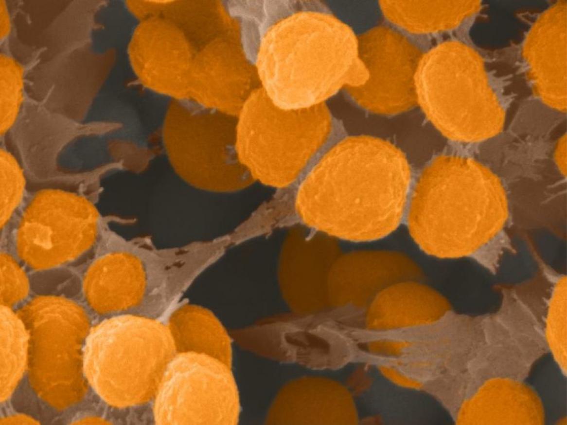 Enlarged and coloured image of biofilm on bacterias