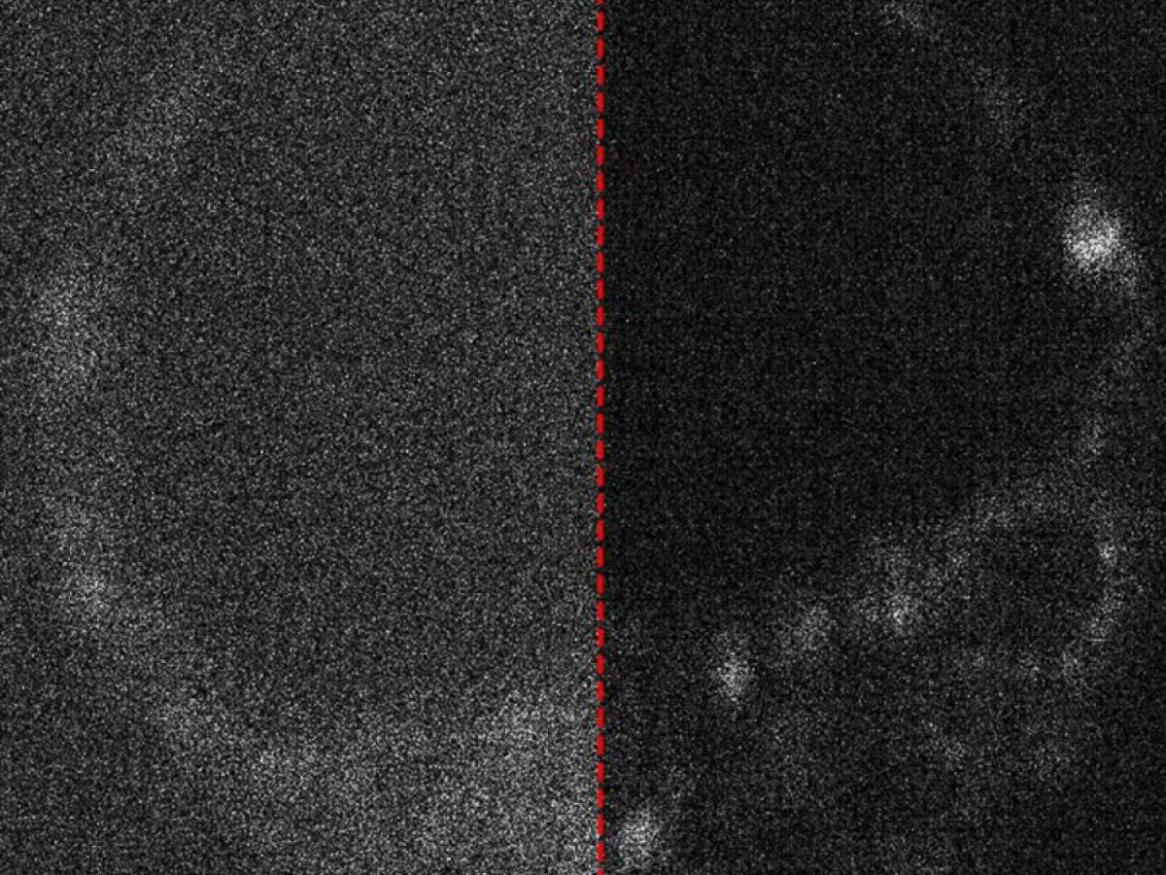 CCD Image of Live Mouse Embryo