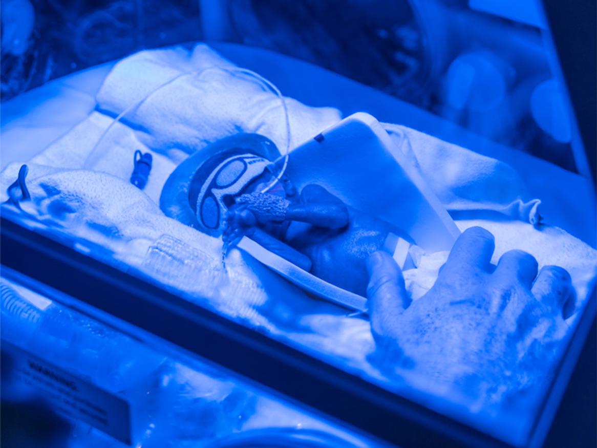 Baby in RRI thumbnail