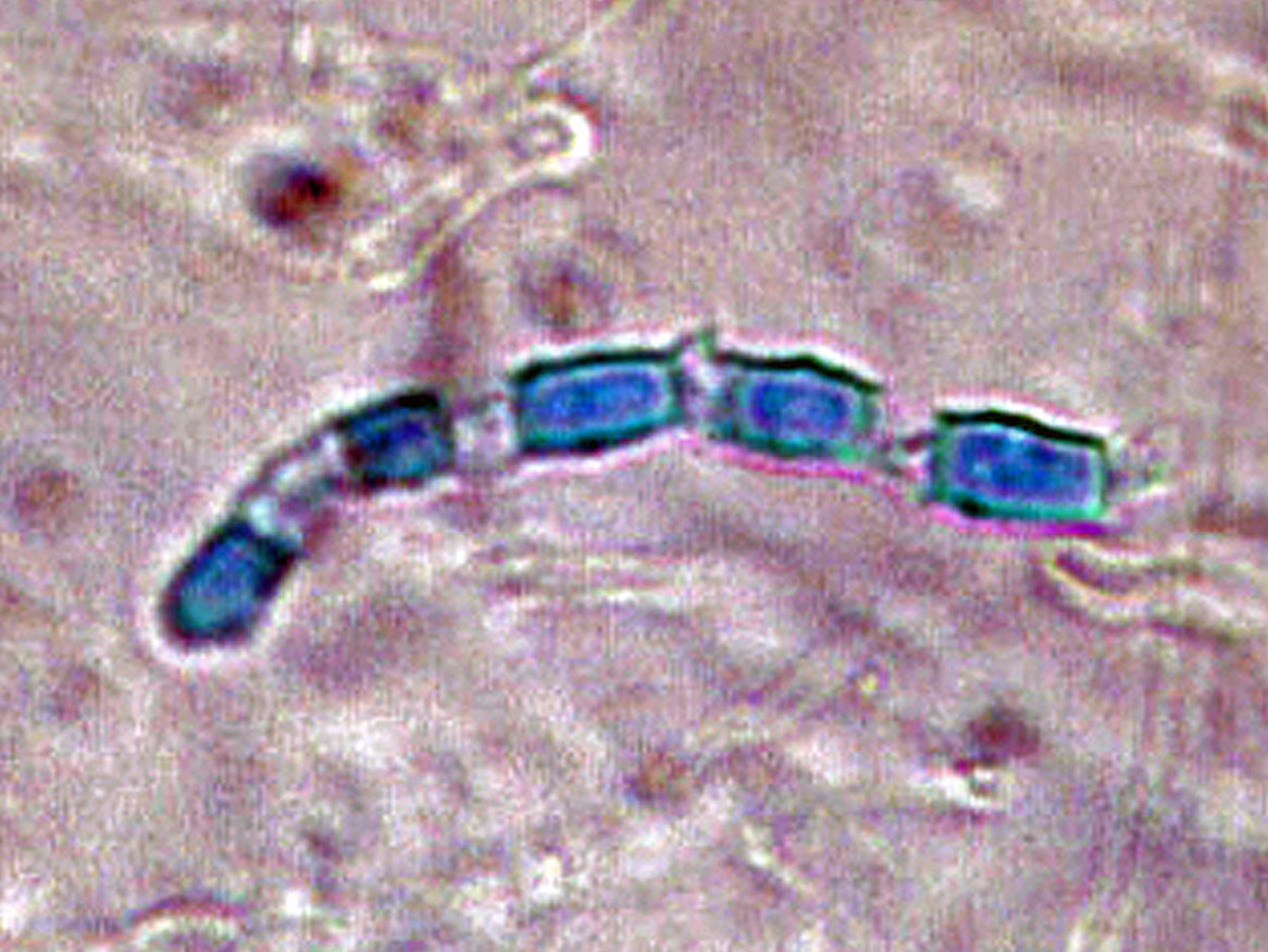 Microscopy