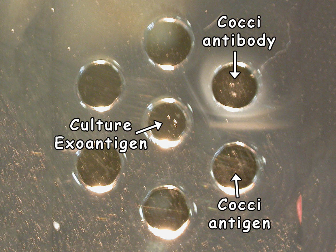 Exoantigen test
