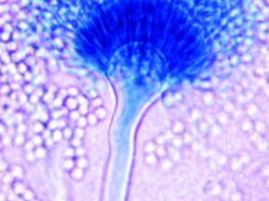 Conidial head of A. terreus. Note: conidial heads are biseriate.