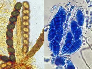 Typical eight-spored asci.