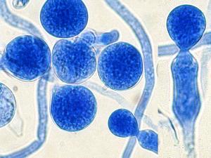 Basidiobolus conidia