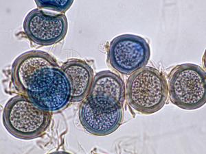 Basidiobolus zygospores