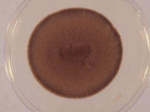 ultures of chromoblastomycosis are typically olivaceous-black.