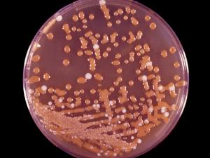 Bird seed agar plate showing the typical brown colour effect seen with C. neoformans.