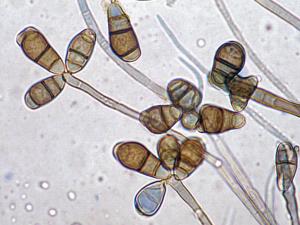 Conidia of Curvularia lunata