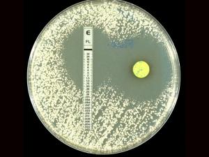 Etest and Neo-Sensitab test (Candida albicans against fluconazole).