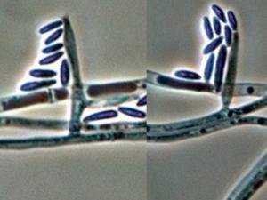 Fusarium oxysporum microconidia on short phialides