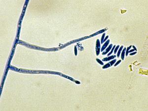 Microconidia on long phialides of F. solani.