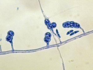 Chlamydospores of F. solani.