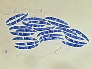 Macroconidia of F. solani.