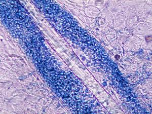 KOH mount of infected hairs showing small spored ectothrix large spored ectothrix invasion by M. gypseum.