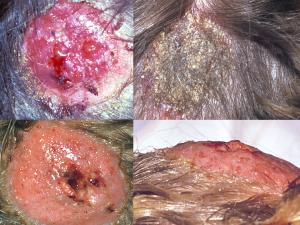 Kerion lesions caused by M. canis (top) following contact with infected cats and T. verrucosum following contact with infected cattle.