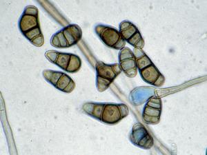 Conidia of Curvularia lunata