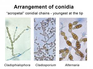 Hyphomycetes (Conidial Moulds) | Mycology | University of Adelaide