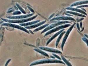 Macroconidia of Fusarium oxysporum