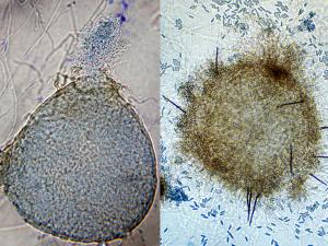 Pycnidia - Coelomycete