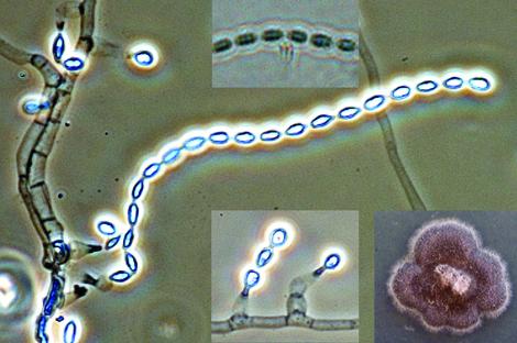 Culture, phialides and conidia with striations of A. fusispora.