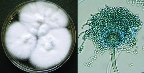 Aspergillus fischeri culture and conidial head