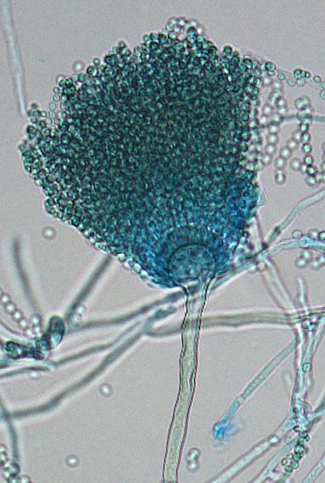 Aspergillus fischeri conidial head morphology