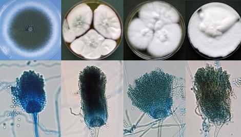 Four species in the Aspergillus fumigatus complex showing overlapping morphological characteristics; (a) Aspergillus fumigatus, (b) Aspergillus lentulus, (c) Neosartorya fischeri and (d) Aspergillus felis.