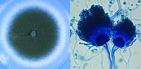 Culture and conidial heads of Aspergillus fumigatus