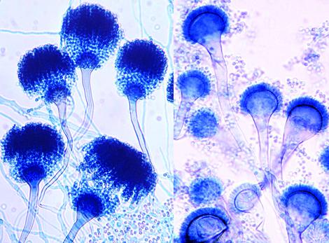 Conidial heads of A. fumigatus. Note: uniseriate row of phialides on the upper two thirds of the vesicle.