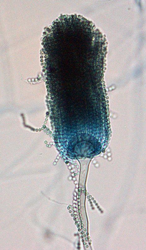 Aspergillus lentulus conidial head morphology