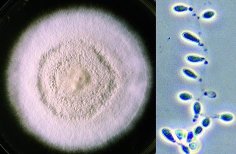 Culture of Chrysosporium tropicum showing typical pyriform to clavate shaped conidia with truncated bases which may be formed either intercalary, laterally or terminally.