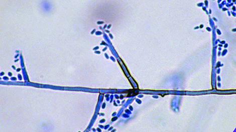 Exophiala spinifera micro