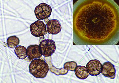 Culture and conidia of Epicoccum nigrum