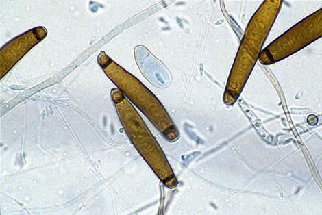 Conidia of Exserohilum rostratum