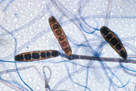 Sympodially elongating conidiophore and conidia of Exserohilum rostratum