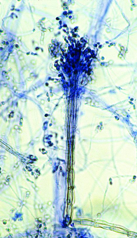 Synnemata and conidia of Graphium spp