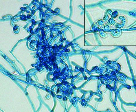 Malbranchea pulchella arthroconidia