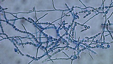 Arthroconidia of Onychocola canadensis